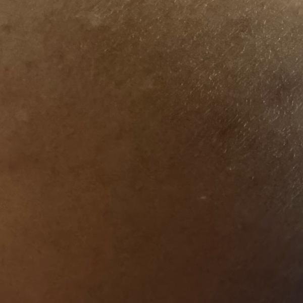 Vibha skin, hair and laser cli
