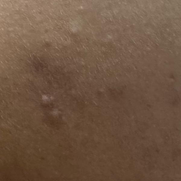 Vibha skin, hair and laser cli