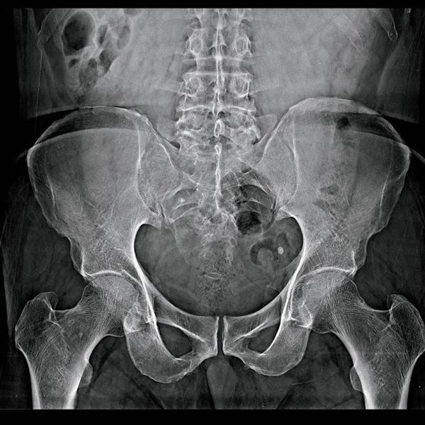 At Dr Mitt