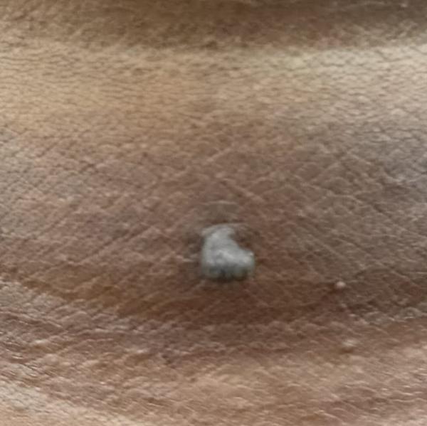 Vibha skin, hair and Laser cli