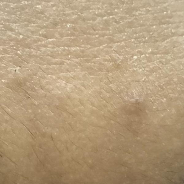 Vibha skin, hair and laser cli