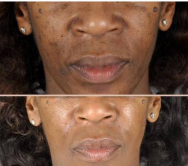 Pigmentation is one of those s