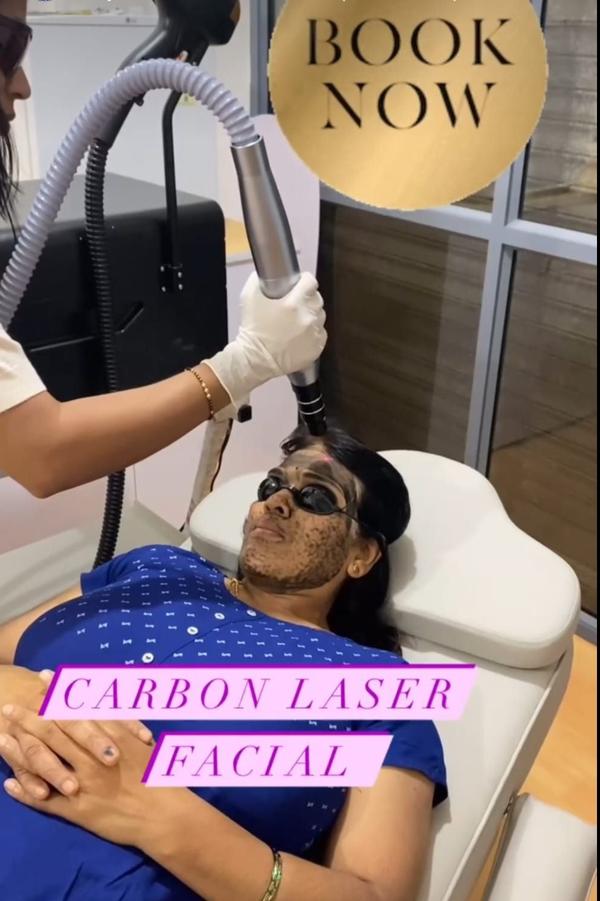 Carbon Las