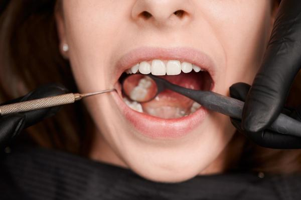 Tooth Extr