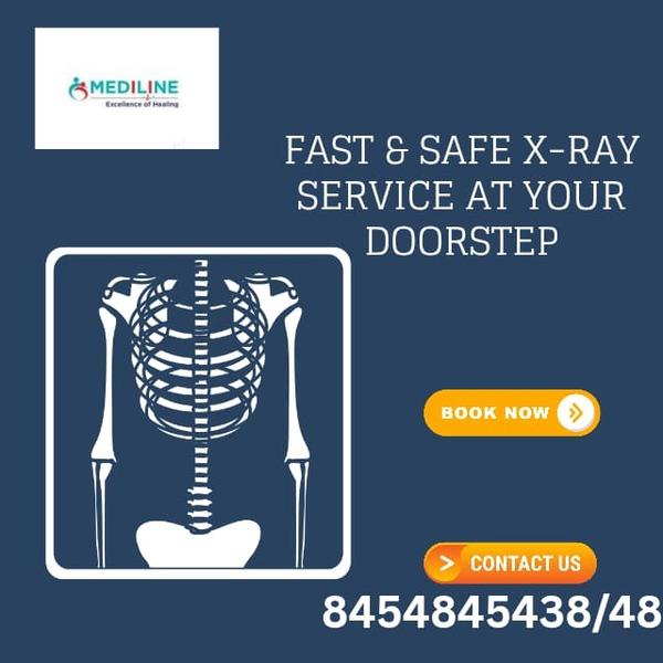 X-Ray at Home in Goregaon