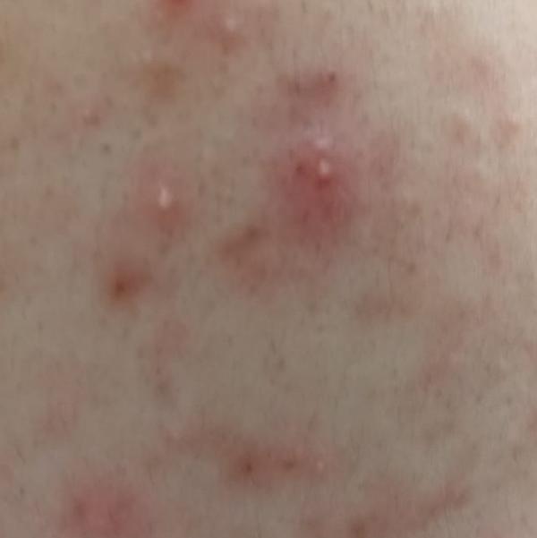Vibha skin, hair and laser cli