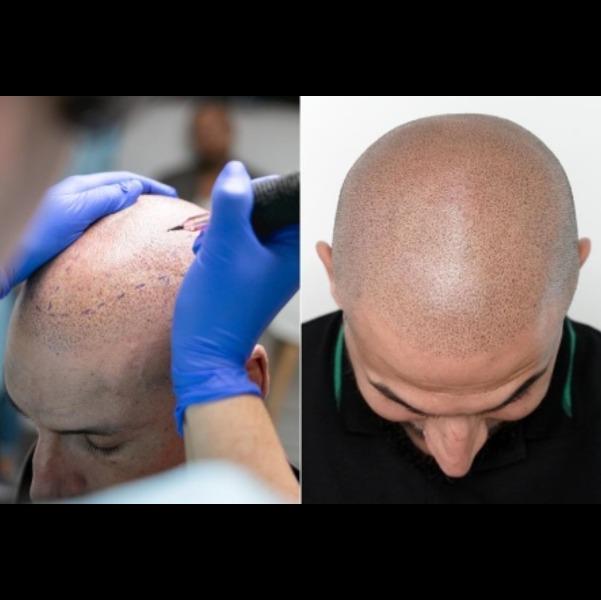 update image