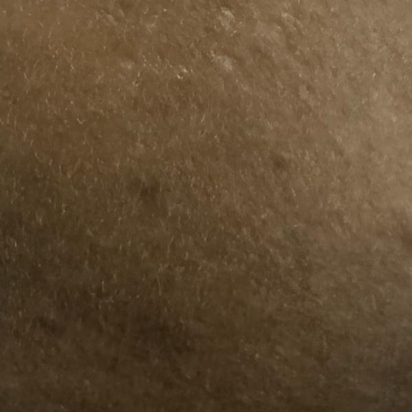 Vibha skin, hair and laser cli