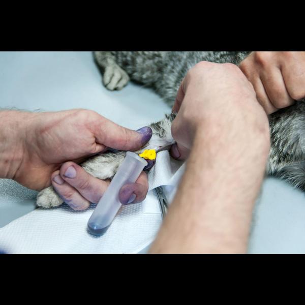 CBC, LFT, and KFT tests help a