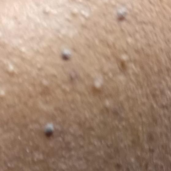 Vibha skin, hair and laser cli