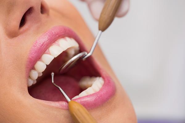 Teeth Clea