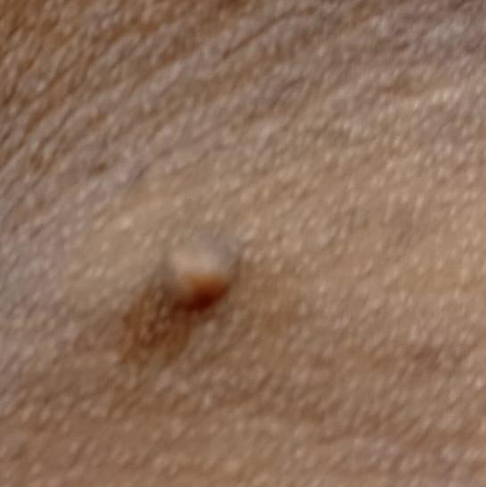 Vibha skin