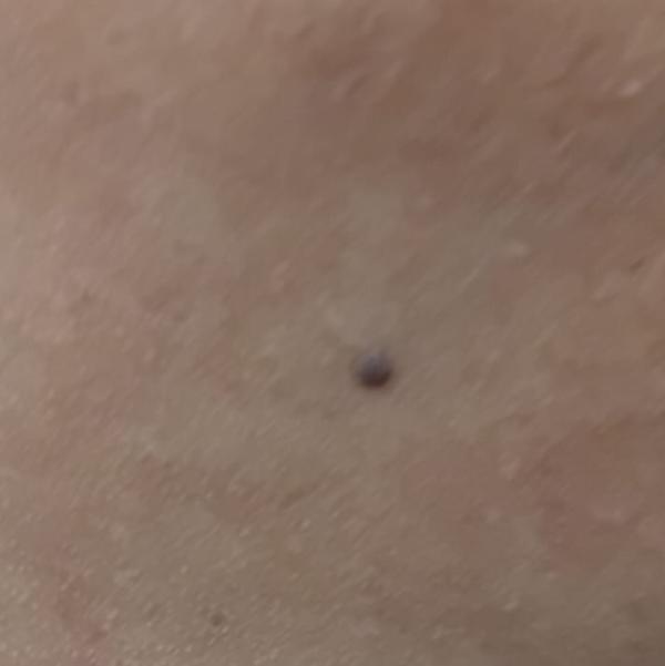 Vibha skin, hair and laser cli