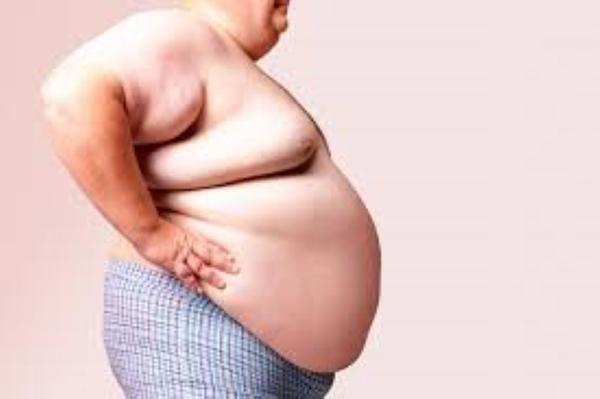 Obesity Di