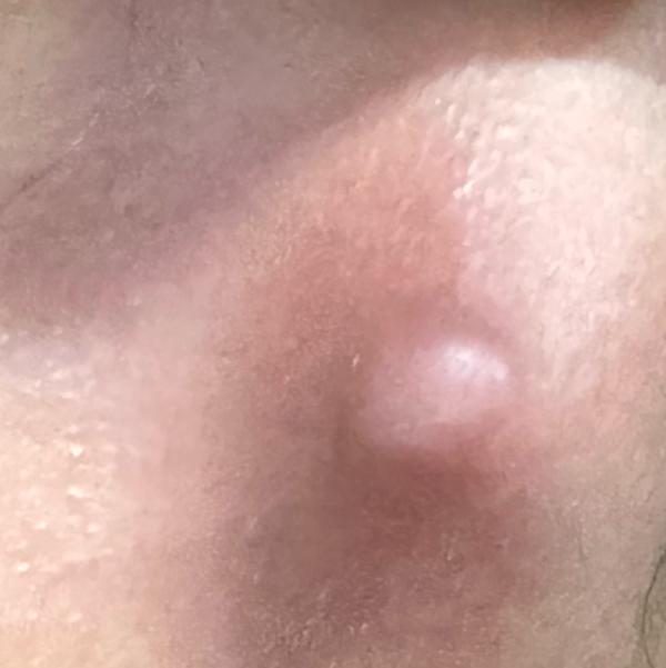 Vibha skin, hair and laser cli