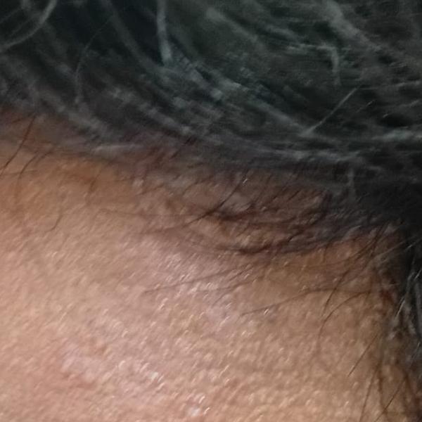 Vibha skin