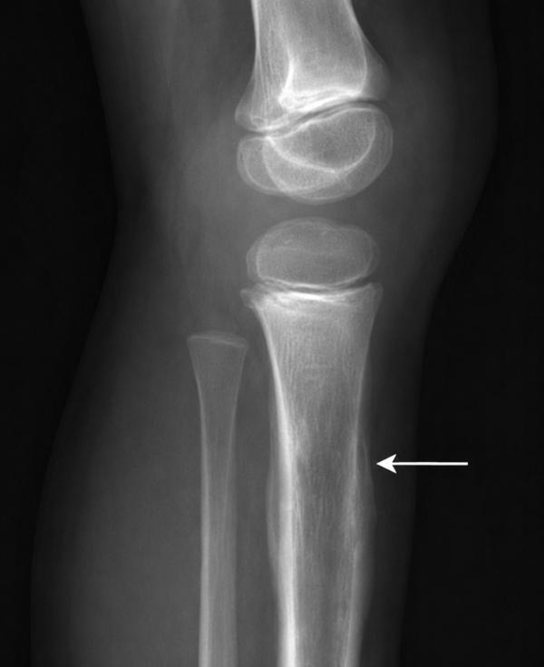 update image