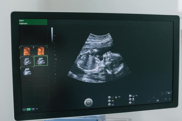 update image