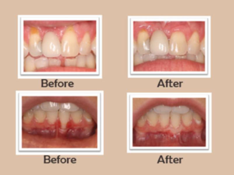 update image