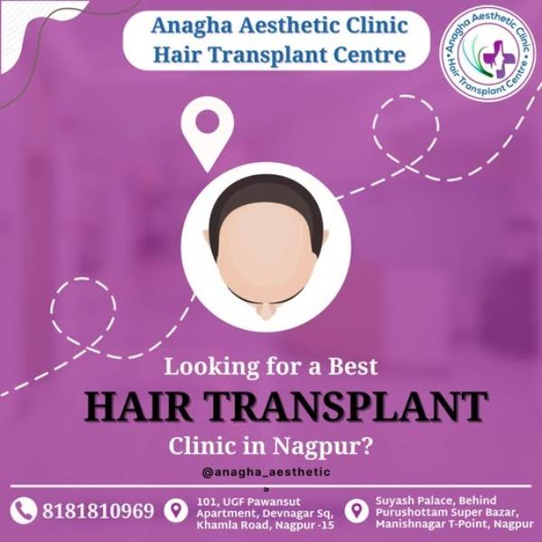  

Hair loss can affect confidence, appe