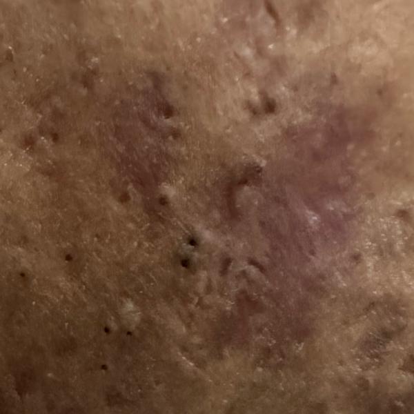 dermatologist specializing in