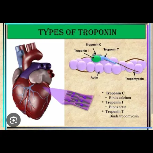 Troponin I and Troponin T are 