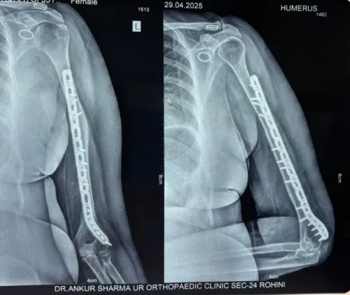 update image