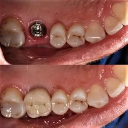 update image