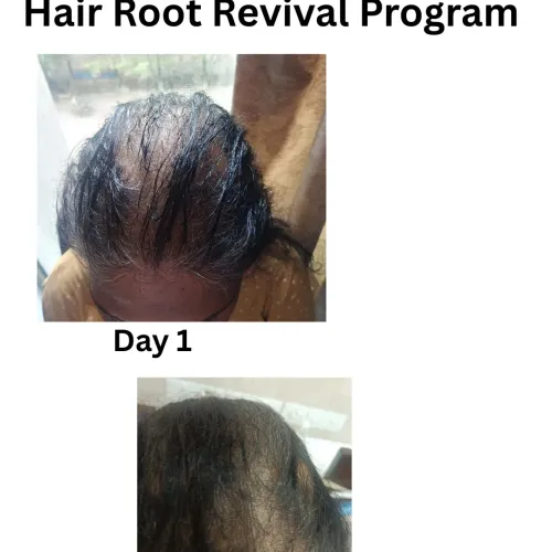 update image