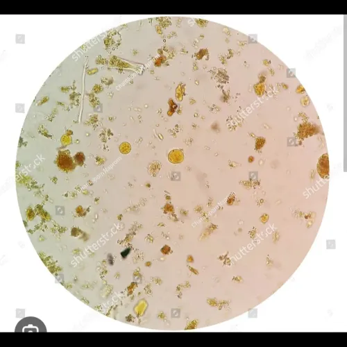Giardia cysts Ova cyst Giardia