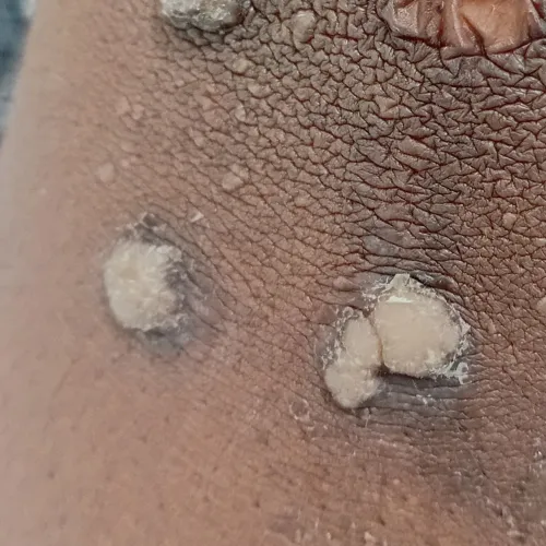 Vibha skin, hair and laser cli