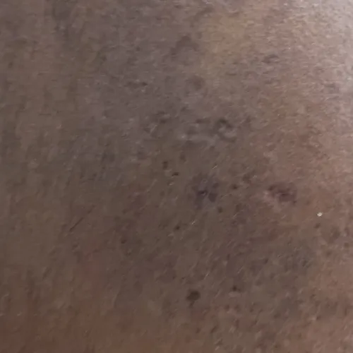 Vibha skin, hair and laser cli