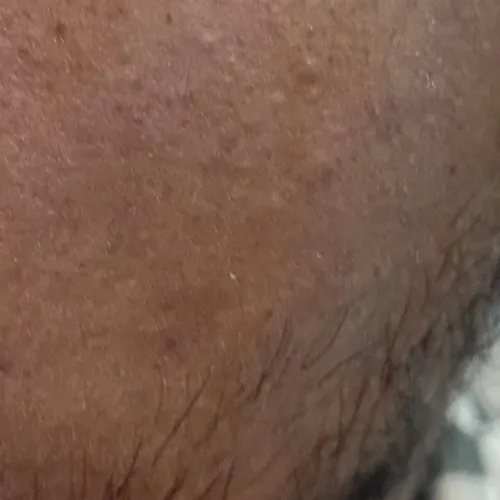 Vibha skin, hair and laser cli