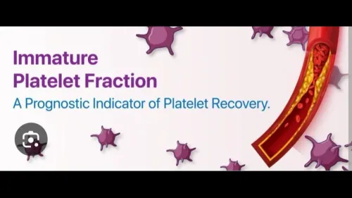 An IPF test can refer to the I