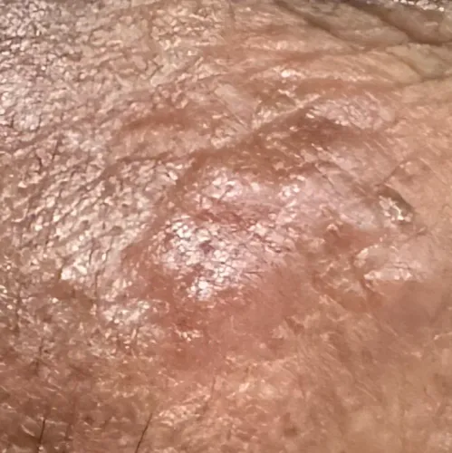 Vibha skin, hair and laser cli