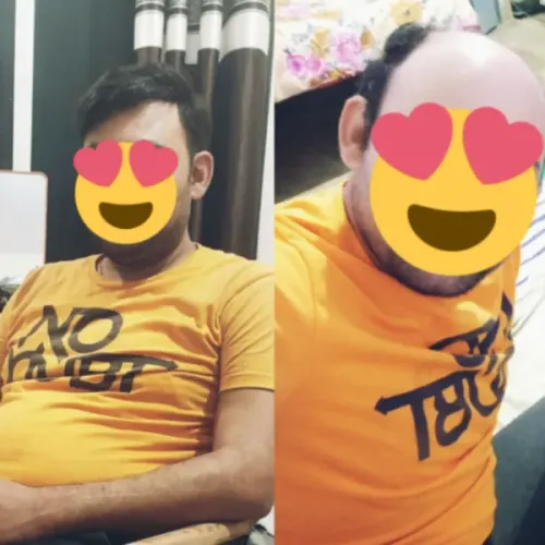 update image