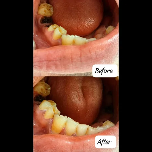 update image