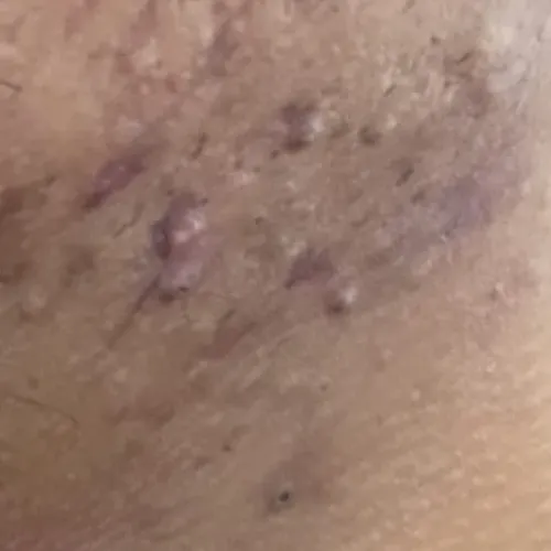 Vibha skin