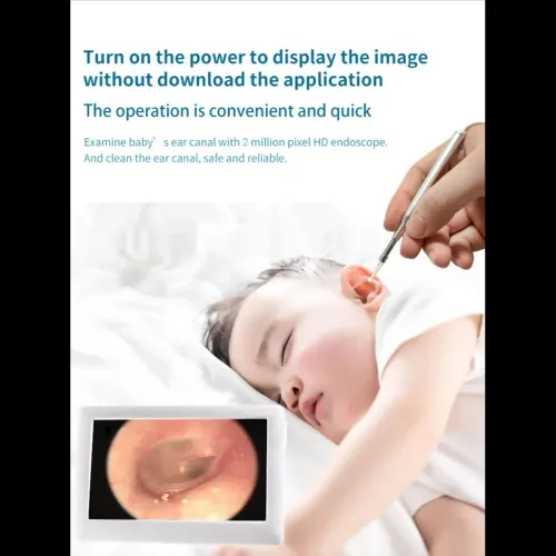 3.9mm HD 1080P medical ho