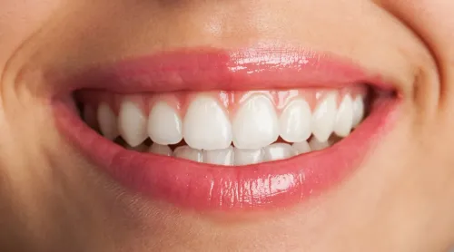  Teeth Whitening in Raja Annam