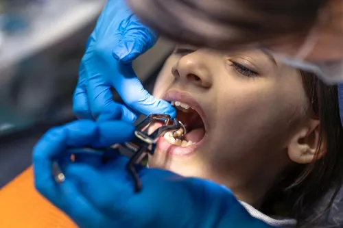 preventive pediatric dentistry