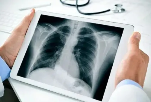 Best X-Ray Centre in Baner, Ba