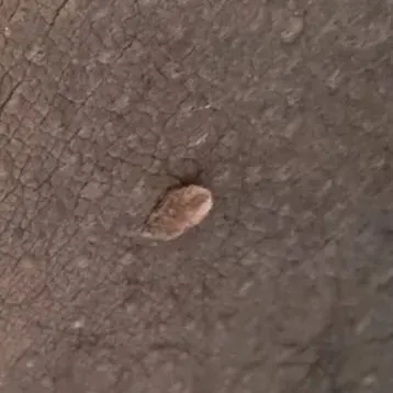 wart removal doctor near me
