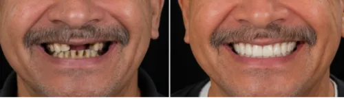 update image