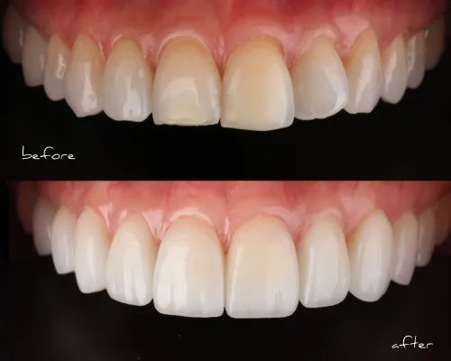 update image
