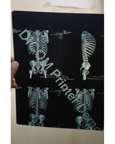 update image