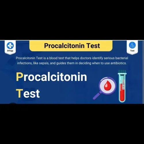 A Procalcitonin (PCT) test is 