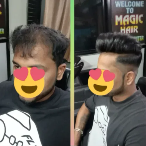 Sometimes, people want a hair replacemen