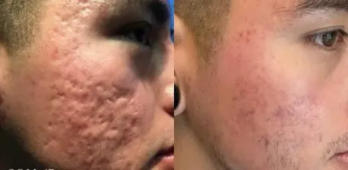 update image
