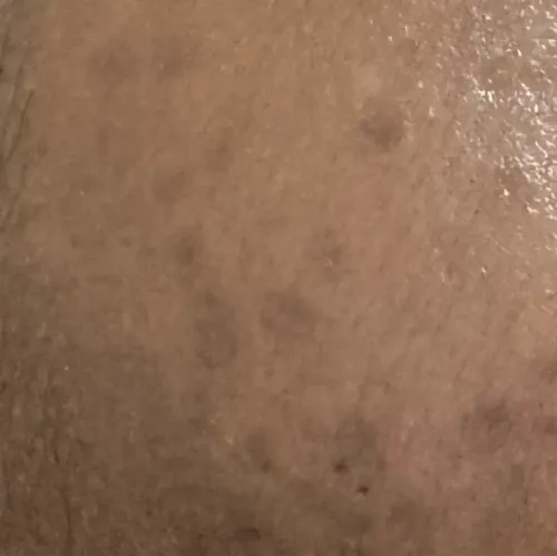 Vibha skin, hair and laser cli